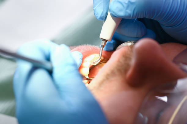Best Pediatric Emergency Dentist in Ben Lomond, CA
