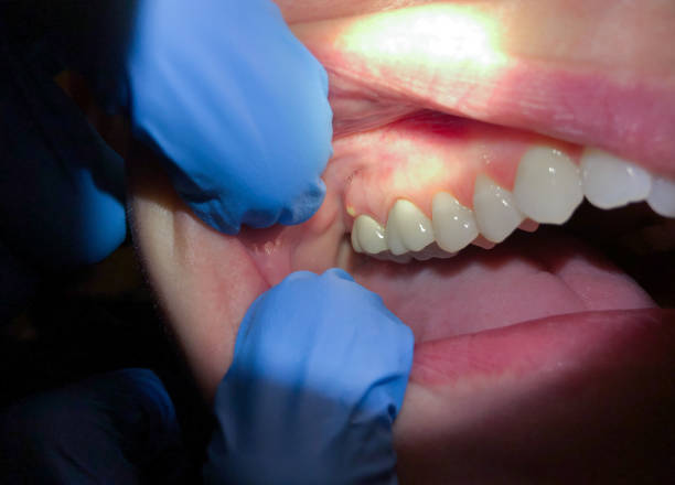 Best Emergency Cosmetic Dentistry in Ben Lomond, CA